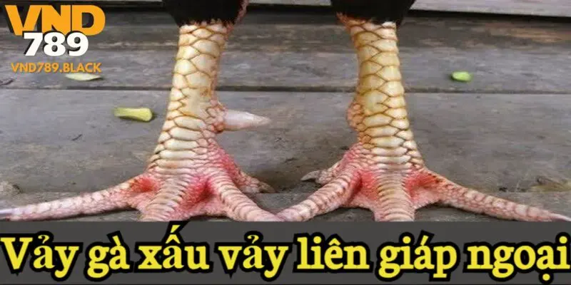 Vảy gà xấu vảy liên giáp ngoại